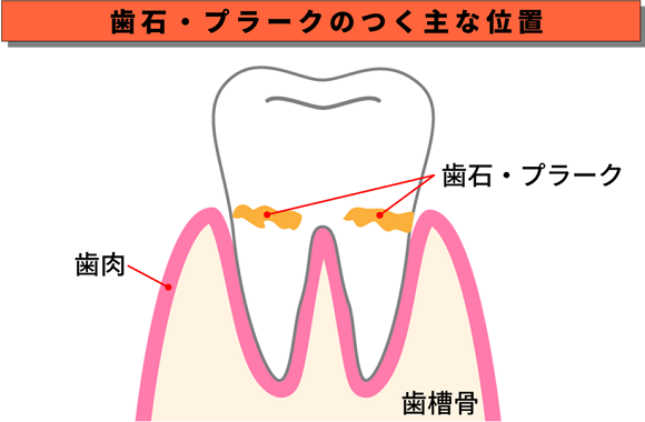 治療画像